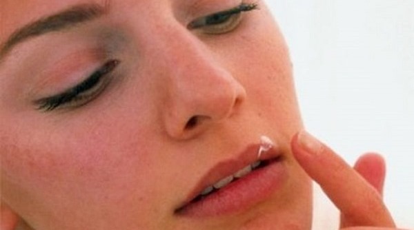 Как лечить простуду на губах