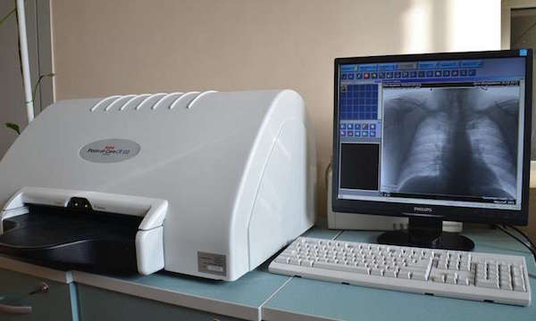 Преимущества цифровых рентгенографических систем
