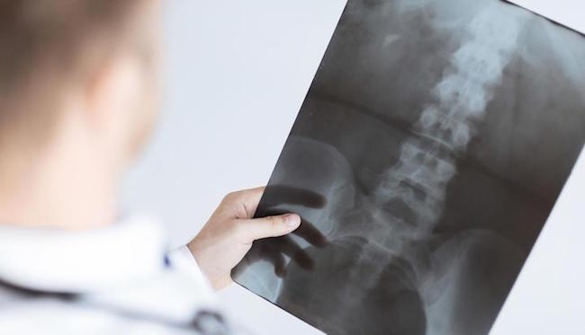 Как подготовиться к рентгенографии позвоночника?