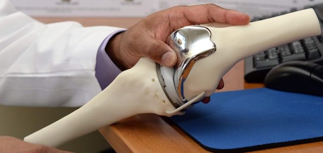 Эндопротезирование коленного сустава в Германии